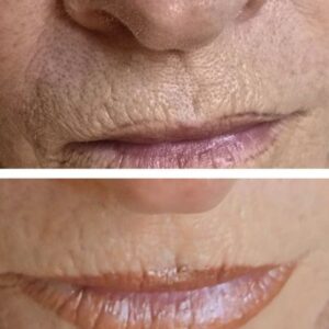 אנטי אייג'ינג 1