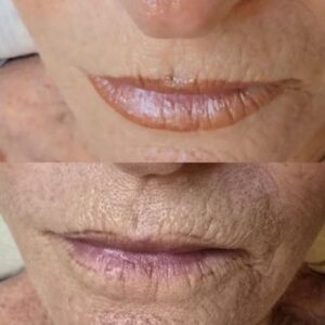 אנטי אייג'ינג 2